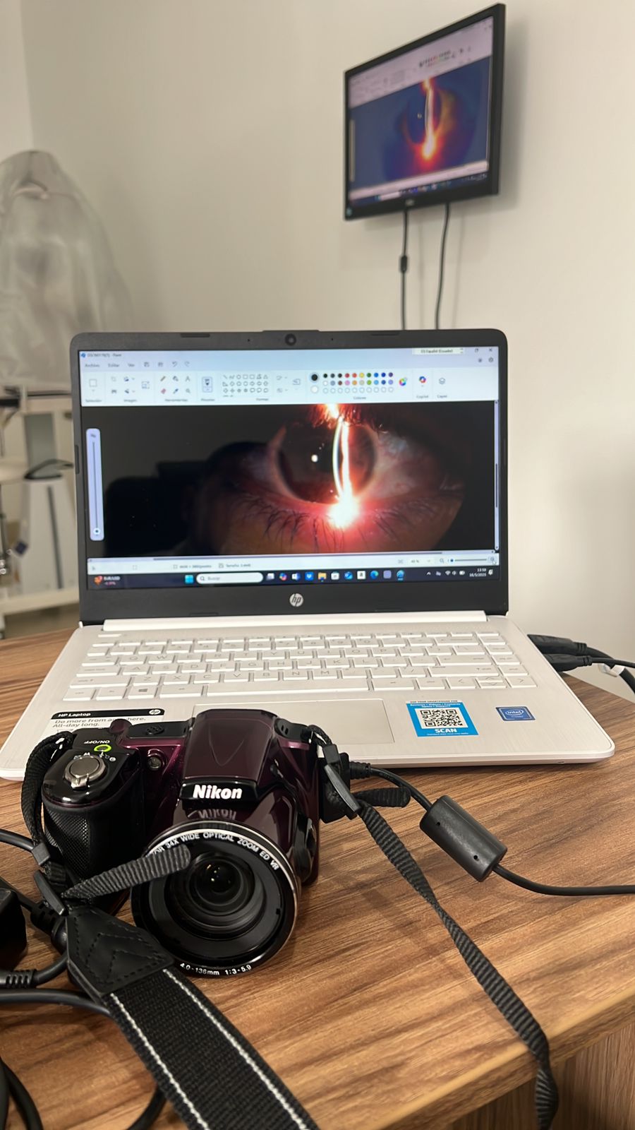 Prótesis Oculares Personalizadas